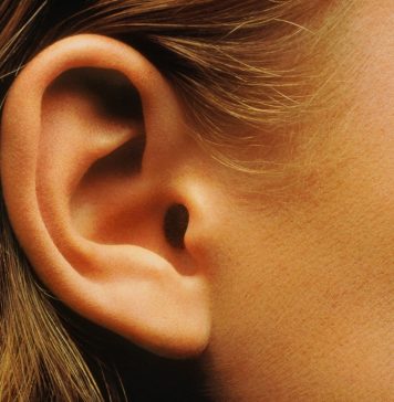 Cum poti avea urechi perfecte cu ajutorul chirurgiei plastice!
