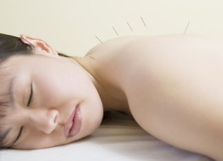 Cum te poate ajuta acupunctura sa te lasi de fumat