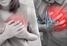Care sunt simptomele unui atac de cord la femei?